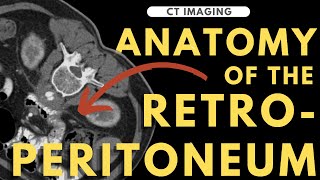 Retroperitoneal anatomy organs and spaces  Radiology anatomy part 1 prep  CT abdomen [upl. by Naujyt587]