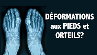 Déformations aux pieds et orteils Programme dexercices niv 1  débutant [upl. by Bina]