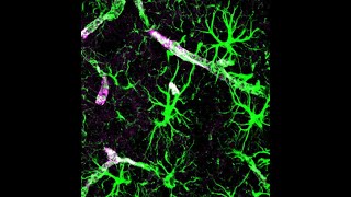 Little Known Functions of the Astrocytes Pr Maurizio de Pitta [upl. by Marras]