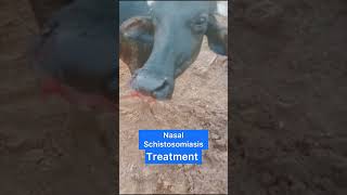 nasal schistosomiasis treatment [upl. by Palmore349]