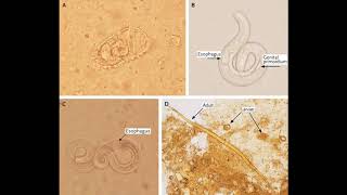 Strongyloides stercoralis  morphology life cycle pathogenesis diagnosis and treatment [upl. by Acinahs]