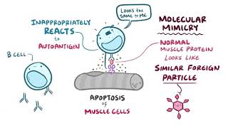 polymyositis [upl. by Murdoch]