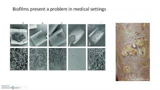 Biofilms and quorum sensing [upl. by Just]