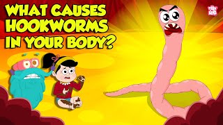 What causes Hookworm। Intestinal Worms Symptoms and Treatment  Worm Infection  Dr Binocs Show [upl. by Hehre318]