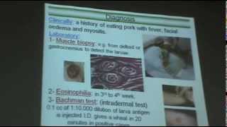 DrAzza Parasitology  Nematodes 6  Tissue Nematodes [upl. by Claretta]