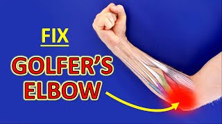 How To Fix Golfers Elbow The 3 BEST Medial Epicondylitis Exercises [upl. by Newmann]