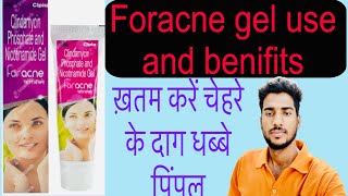 Foracne gel useदाग धब्बे पिंपलyoutubemadicinepharmacyytdoctorhospitalmedicalpimpleuse [upl. by Zanlog467]