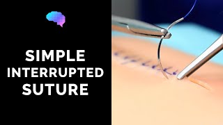 Simple interrupted suture wound suturing  OSCE Guide  UKMLA  CPSA [upl. by Elbon]