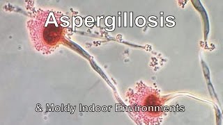 Aspergillosis amp Moldy Indoor Environments [upl. by Eellehs]