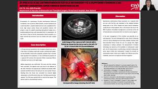 ESVS 35th Annual Meeting 2021 Eposter Presentation [upl. by Yesoj520]