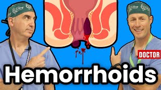 How To Get Rid Of Hemorrhoids [upl. by Ahgem853]