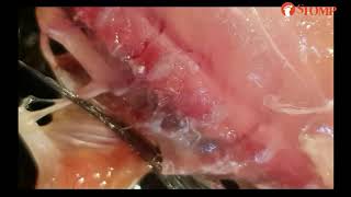 Diner finds parasite wriggling in sashimi from Don Don Donki SFA investigating [upl. by Isteb]