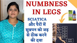 Numbness in Legs ॥ Sciatica और पैरों में सुन्नपन को जड़ से ठीक करने की दवा ॥ Gnaphalium for numbness [upl. by Parnas]