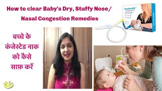 How to Treat Nasal congestionStuffy nose in Babies  Nasobuddy Nasal Aspirator Blocked nose [upl. by Nivac]