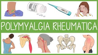 Polymyalgia Rheumatica [upl. by Edwyna782]