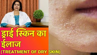 सूखी त्वचा  ड्राई स्किन का ईलाज  Dry Skin Treatment In HINDI [upl. by Conard]