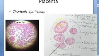 Obstetrics 243 GESTATIONAL TROPHOBLASTIC DISEASES Placental tumor Hydatidiform Mole Choriocarcinoma [upl. by Ettegdirb]