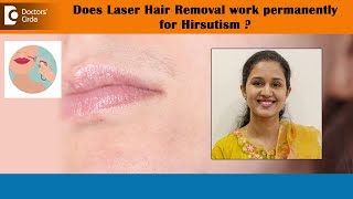 Laser Hair Removal for Hirsutism Excessive hair in FemaleHIRSUTISMDrAbhijna Rai Doctors’ Circle [upl. by Det464]