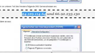 Tutorial DNS Einstellung ändern bei Vista [upl. by Garrett]