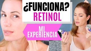 ¿FUNCIONA EL RETINOL Mi experiencia  Desiree Lowry [upl. by Gebelein328]