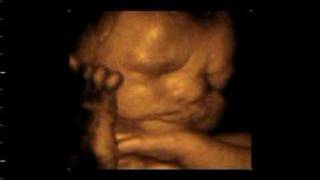 Fetal Vision Imaging 4D Ultrasound wwwfetalvisionimagingcom [upl. by Sukhum412]