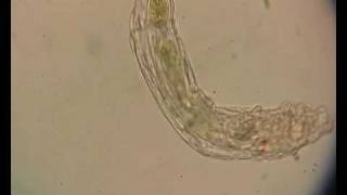 Rotifer [upl. by Anav]