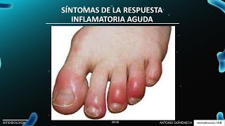 Sesión I3 Microbiología complemento fagocitosis e inflamación [upl. by Udenihc]