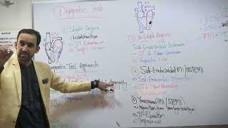 Complications of MI Myocardial infarction ComplicationsDiagnosis of MIlife threatening Arrhythmia [upl. by Kcirtemed]