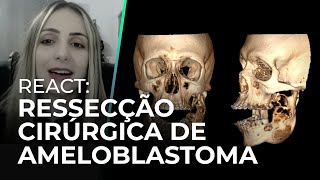 REACT RESSECÇÃO CIRÚRGICA DE AMELOBLASTOMA [upl. by Tatiana262]