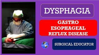 GASTROESOPHAGEAL REFLUX DISEASE  How To DIAGNOSE amp TREAT DYSPHAGIA [upl. by Rohpotsirhc]