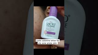 Lacto calamine face lotion review lacto calamine lotion for acne prone skin review shorts [upl. by Orianna]