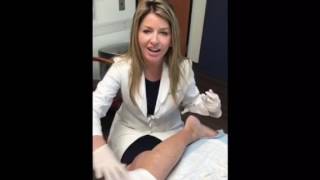 Sclerotherapy Treatment by Dr Fabi in San Diego [upl. by Attwood843]