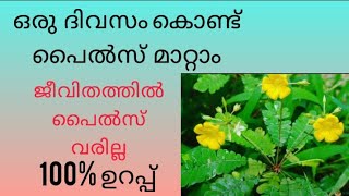 മൂലക്കുരു എങ്ങനെ മാറ്റാം  piles treatment at home  permanent home treatment for piles in malayalam [upl. by Henryson]