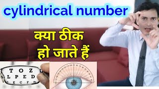 आंखों में Cylindrical number क्या ठीक हो जाते हैं [upl. by Gnos]