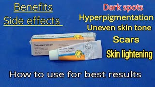 Skinoren cream  Skinoren cream before and after  Azelaic acid  honest review [upl. by Einaj]