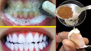 Secret that Dentists dont want you to know Remove Tartar and Teeth whitening in just 2 minutes 🪥 [upl. by Yednarb131]