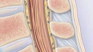 Comment pratiquer une ponction lombaire [upl. by Guilbert]