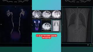 CHECK CT SCAN UROGRAPHY [upl. by Ener]