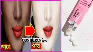 ৫ দিনে ফর্সা করে যারা ৩ থেকে ৪ সেট ফর্সা হতে চান তাদের জন্য Re turn whitening cream  khadija b [upl. by Raimes]