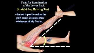 Tests For Examination Of The Lower Back  Everything You Need To Know  Dr Nabil Ebraheim [upl. by Akilam]