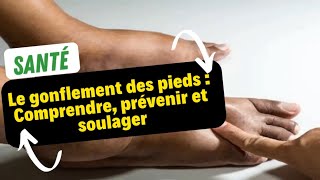 Le gonflement des pieds  Comprendre prévenir et soulager [upl. by Humfrid396]