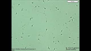 Sperm Motility Assessment exercise 4 [upl. by Neeli]