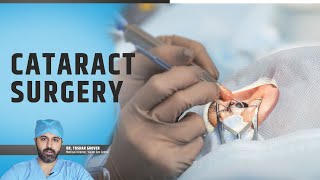 Complete Guide to Cataract Surgery in 2024 Before During After [upl. by Comras962]