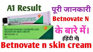 Betnovate N cream  Betnovate N cream review  Betnovate N cream benifit on skin [upl. by Issak678]